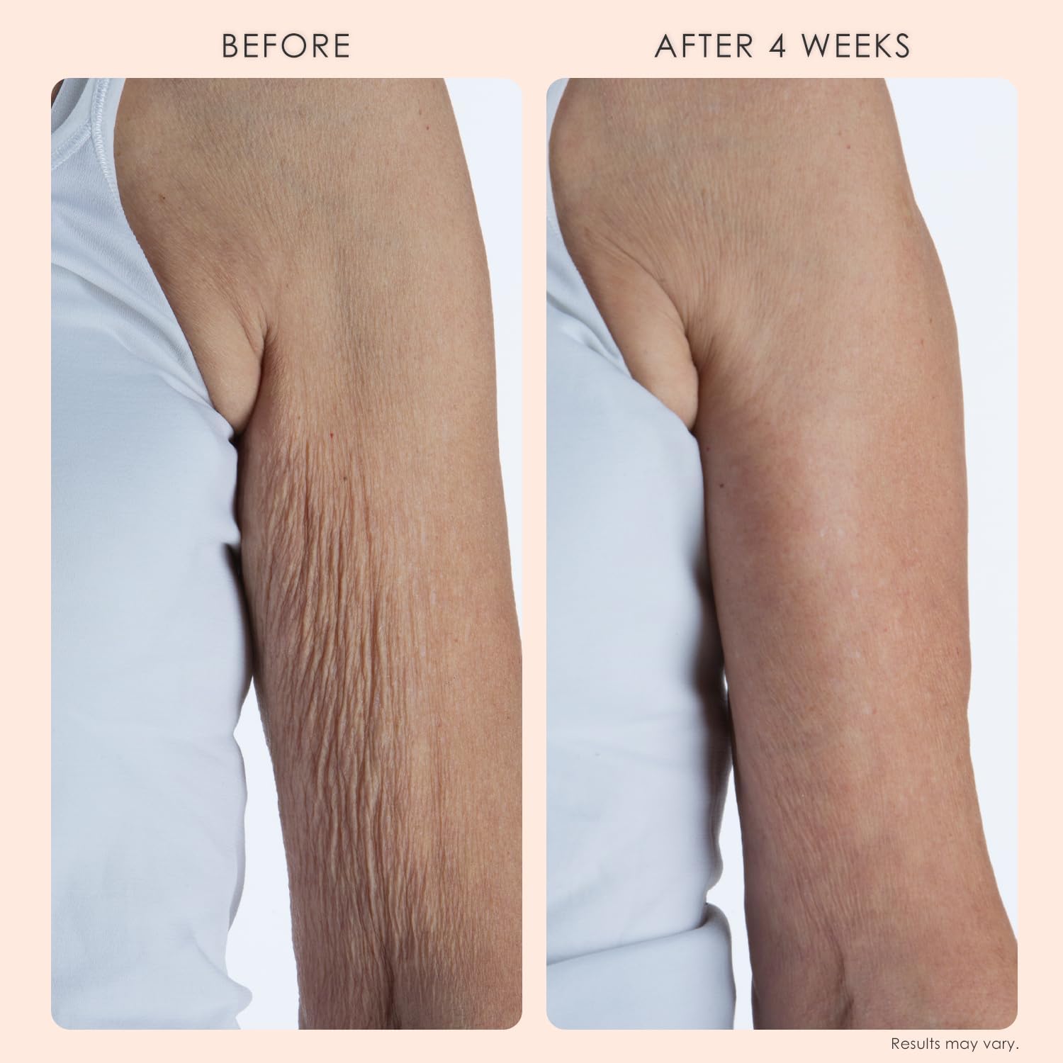 Crepe Erase BODY FIRM 2Step Treatment, AntiAging Face & Body Care, 10 Oz Gallery Photo 3