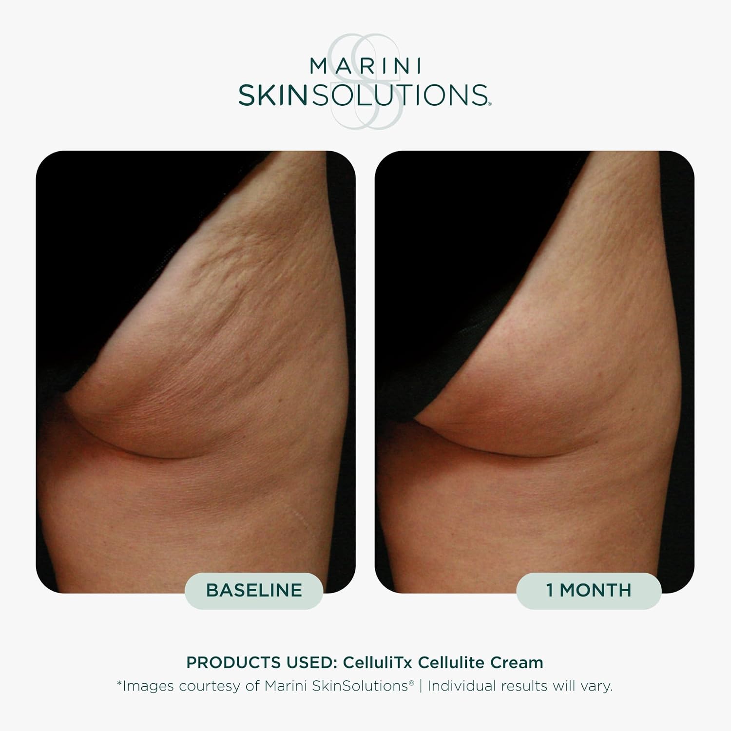 Marini SkinSolutions CelluliTX: Cellulite Thigh Cream with Aminophylline, Retinol, Peptides & Caffeine 4 oz Gallery Photo 3