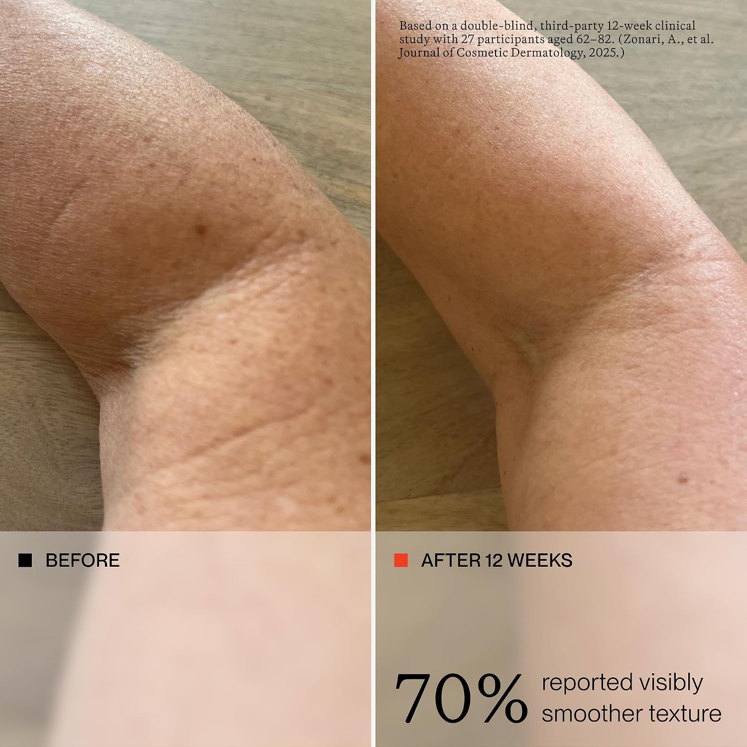 oneskin OS01 BODY Topical Supplement Moisturizer | Age Reversal, 8.45 Oz Gallery Photo 4